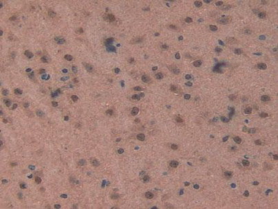 Immunohistochemistry (Formalin/PFA-fixed paraffin-embedded sections) - Anti-GSTK1 antibody (AB231549), expandable thumbnail