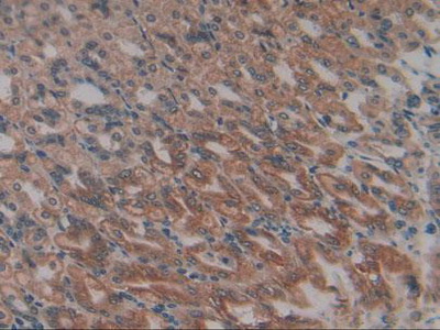 Immunohistochemistry (Formalin/PFA-fixed paraffin-embedded sections) - Anti-GSTK1 antibody (AB231549), expandable thumbnail