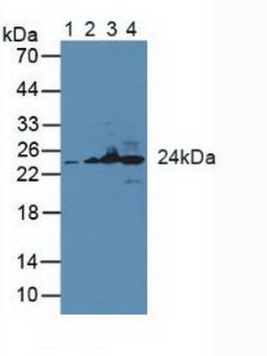 Western blot - Anti-GSTK1 antibody (AB231549), expandable thumbnail