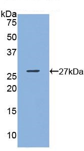 Western blot - Anti-GSTK1 antibody (ab231549), expandable thumbnail