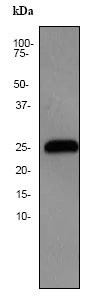 Western blot - Anti-GSTK1 antibody [EP1938Y] (AB52759)