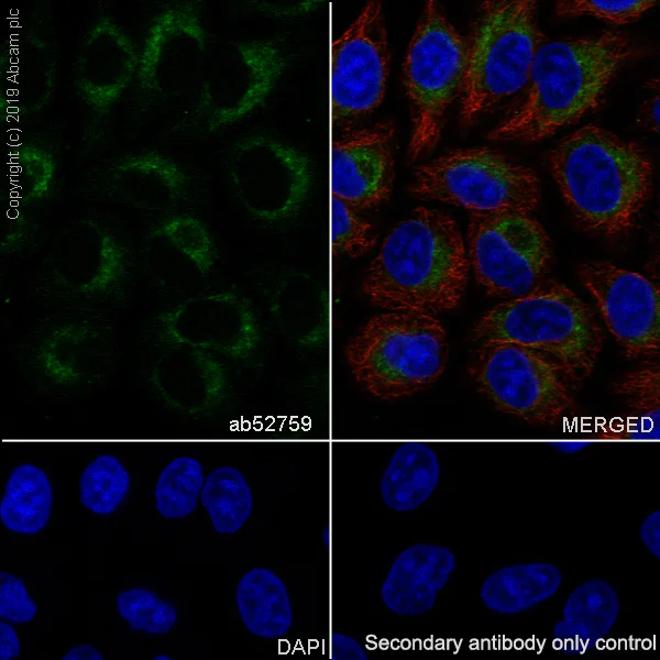 Immunocytochemistry/ Immunofluorescence - Anti-GSTK1 antibody [EP1938Y] - BSA and Azide free (AB247331)