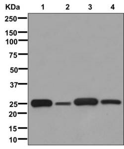 Western blot - Anti-GSTM1/2/4/5 antibody [EPR13338] (AB178684)