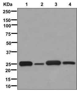 Western blot - Anti-GSTM1/2/4/5 antibody [EPR13338] (AB178684)