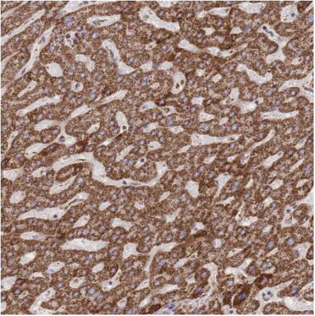 Immunohistochemistry (Formalin/PFA-fixed paraffin-embedded sections) - Anti-GSTM1 antibody (AB244483)