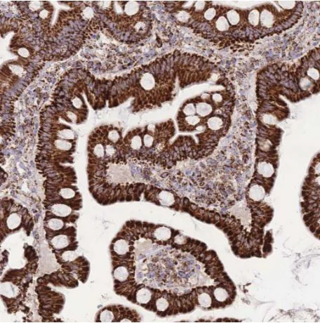 Immunohistochemistry (Formalin/PFA-fixed paraffin-embedded sections) - Anti-GSTM1 antibody (AB244483)
