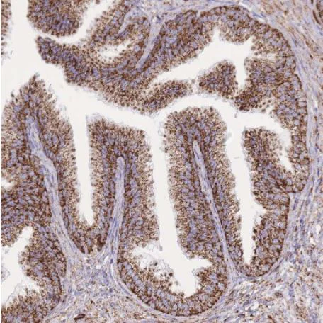 Immunohistochemistry (Formalin/PFA-fixed paraffin-embedded sections) - Anti-GSTM1 antibody (AB244483)