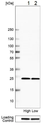 Western blot - Anti-GSTM1 antibody (AB244483)