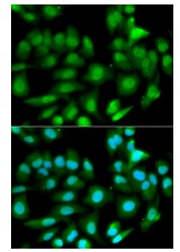 Immunocytochemistry/ Immunofluorescence - Anti-GSTM2 antibody (AB196503), expandable thumbnail