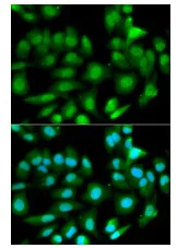 Immunocytochemistry/ Immunofluorescence - Anti-GSTM2 antibody (AB196503)