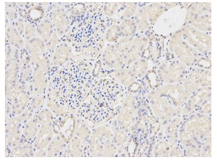 Immunohistochemistry (Formalin/PFA-fixed paraffin-embedded sections) - Anti-GSTM2 antibody (AB196503), expandable thumbnail