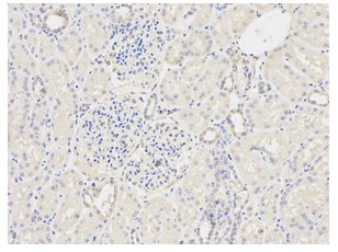 Immunohistochemistry (Formalin/PFA-fixed paraffin-embedded sections) - Anti-GSTM2 antibody (AB196503)