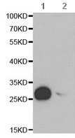 Western blot - Anti-GSTM2 antibody (AB196503), expandable thumbnail
