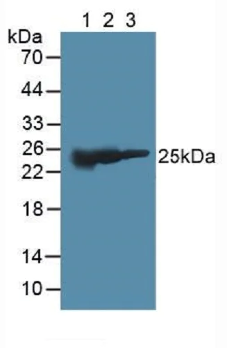 Western blot - Anti-GSTM2 antibody (AB232860)