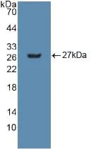 Western blot - Anti-GSTM2 antibody (AB232860)