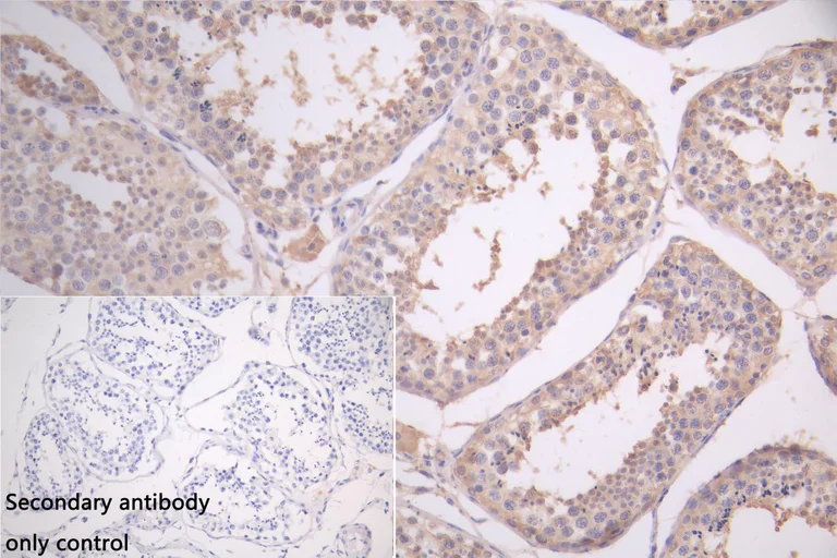 Immunohistochemistry (Formalin/PFA-fixed paraffin-embedded sections) - Anti-GSTM3 antibody (AB229858)