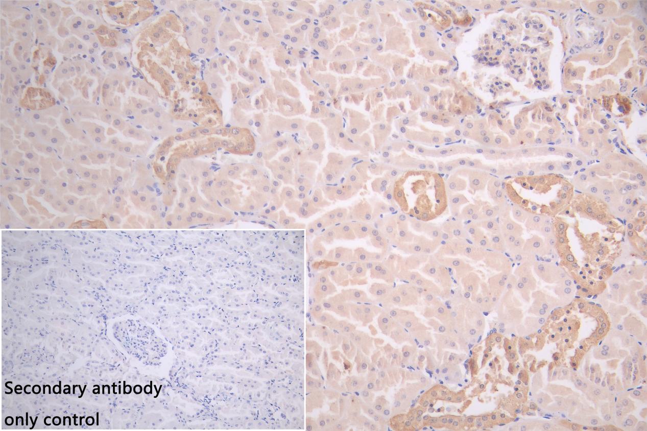 Immunohistochemistry (Formalin/PFA-fixed paraffin-embedded sections) - Anti-GSTM3 antibody (AB229858)