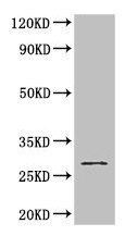 Western blot - Anti-GSTM3 antibody (AB229858)