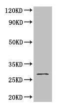 Western blot - Anti-GSTM3 antibody (AB229858)