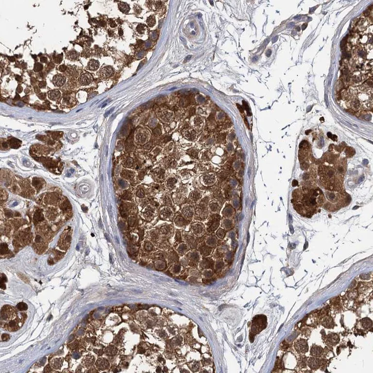 Immunohistochemistry (Formalin/PFA-fixed paraffin-embedded sections) - Anti-GSTM3 antibody (AB272613)
