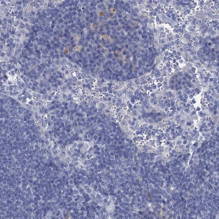 Immunohistochemistry (Formalin/PFA-fixed paraffin-embedded sections) - Anti-GSTM3 antibody (AB272613)