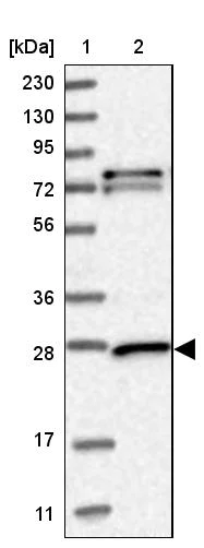Western blot - Anti-GSTM3 antibody (AB272613)