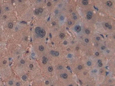 Immunohistochemistry (Formalin/PFA-fixed paraffin-embedded sections) - Anti-GSTM4 antibody (AB233281)