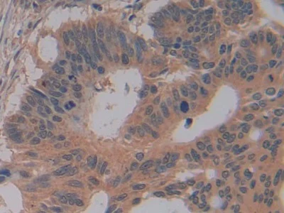 Immunohistochemistry (Formalin/PFA-fixed paraffin-embedded sections) - Anti-GSTM4 antibody (AB233281)