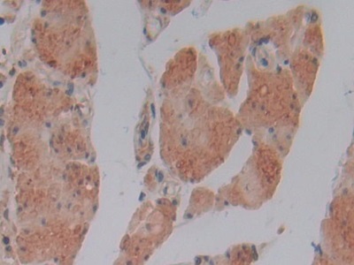 Immunohistochemistry (Formalin/PFA-fixed paraffin-embedded sections) - Anti-GSTM4 antibody (AB233281)