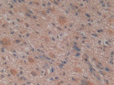 Immunohistochemistry (Formalin/PFA-fixed paraffin-embedded sections) - Anti-GSTM4 antibody (AB233281)