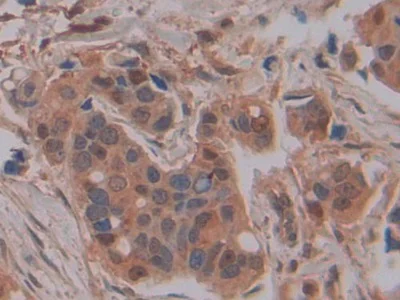 Immunohistochemistry (Formalin/PFA-fixed paraffin-embedded sections) - Anti-GSTM4 antibody (AB233281)