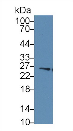 Western blot - Anti-GSTM4 antibody (AB233281)