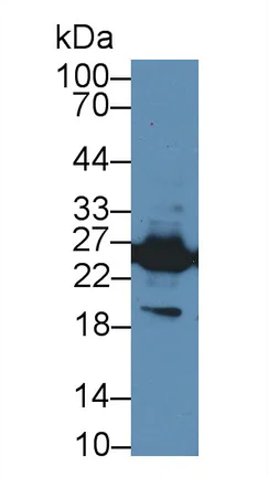 Western blot - Anti-GSTM4 antibody (AB233281)