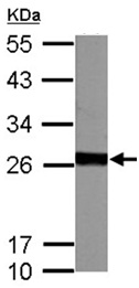 Western blot - Anti-GSTM5 antibody (AB154018), expandable thumbnail