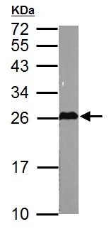 Western blot - Anti-GSTM5 antibody (AB154018), expandable thumbnail