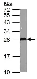 Anti-GSTM5 antibody (ab154018) | Abcam