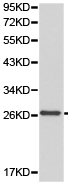 Western blot - Anti-GSTT1 antibody (AB175418)