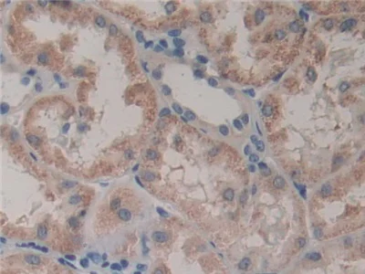 Immunohistochemistry (Formalin/PFA-fixed paraffin-embedded sections) - Anti-GSTT2 antibody (AB231792)
