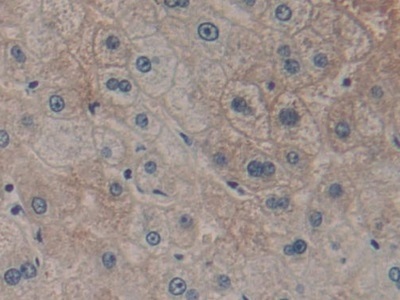 Immunohistochemistry (Formalin/PFA-fixed paraffin-embedded sections) - Anti-GSTT2 antibody (AB231792)
