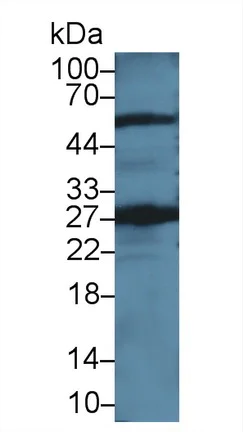 Western blot - Anti-GSTT2 antibody (AB231792)