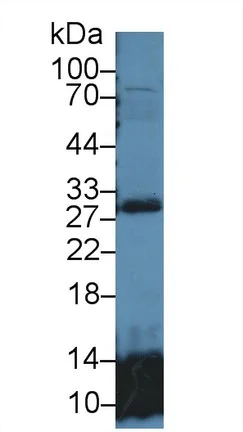 Western blot - Anti-GSTT2 antibody (AB231792)