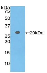 Western blot - Anti-GSTT2 antibody (AB231792)