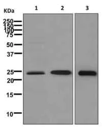 Western blot - Anti-GSTT2 antibody [EPR8136(2)] (AB176336)