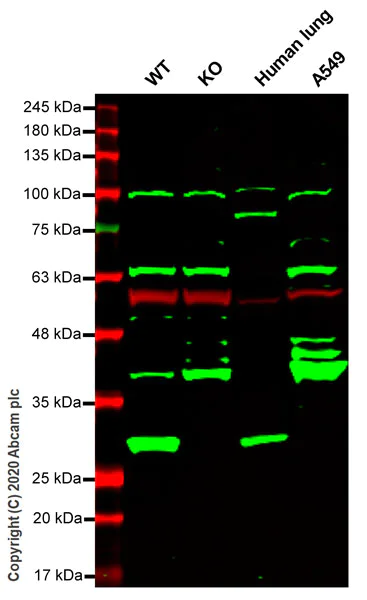 Western blot - Anti-GSTT2 antibody [EPR8136(2)] - BSA and Azide free (AB249912)