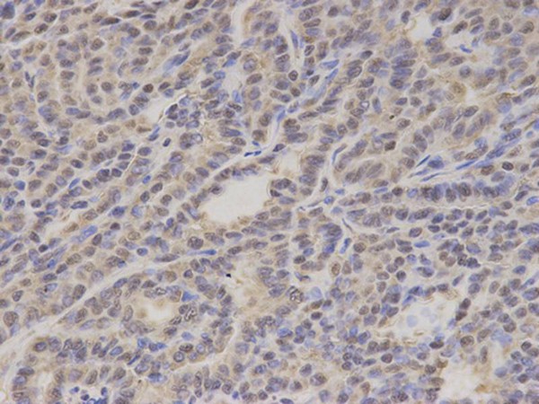 Immunohistochemistry (Formalin/PFA-fixed paraffin-embedded sections) - Anti-GTF2A1 antibody (AB196770)