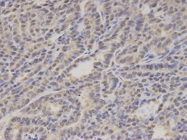 Immunohistochemistry (Formalin/PFA-fixed paraffin-embedded sections) - Anti-GTF2A1 antibody (AB196770)