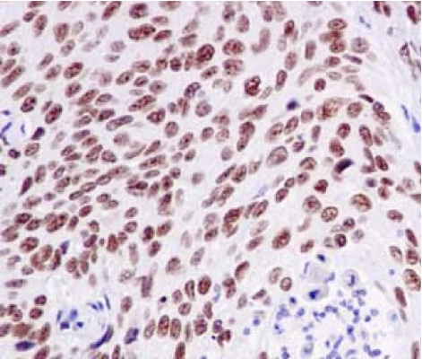 Immunohistochemistry (Formalin/PFA-fixed paraffin-embedded sections) - Anti-GTF2E2 antibody [EPR14929] (AB187143)