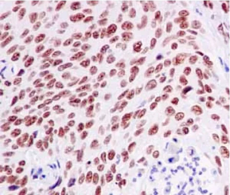 Immunohistochemistry (Formalin/PFA-fixed paraffin-embedded sections) - Anti-GTF2E2 antibody [EPR14929] (AB187143)