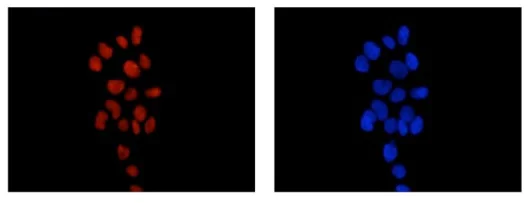 Immunocytochemistry/ Immunofluorescence - Anti-GTF2E2 antibody [EPR14929] - BSA and Azide free (AB250907)