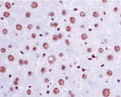 Immunohistochemistry (Formalin/PFA-fixed paraffin-embedded sections) - Anti-GTF2E2 antibody [EPR14929] - BSA and Azide free (AB250907)